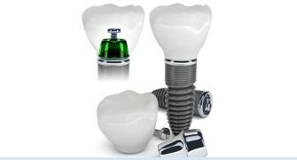 implant dentar