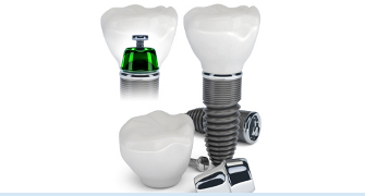 implantul dentar si coroana dentara
